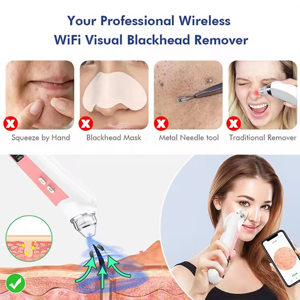 6 Heads Pore Cleaner Blackhead - Nasal Aspirator review and price