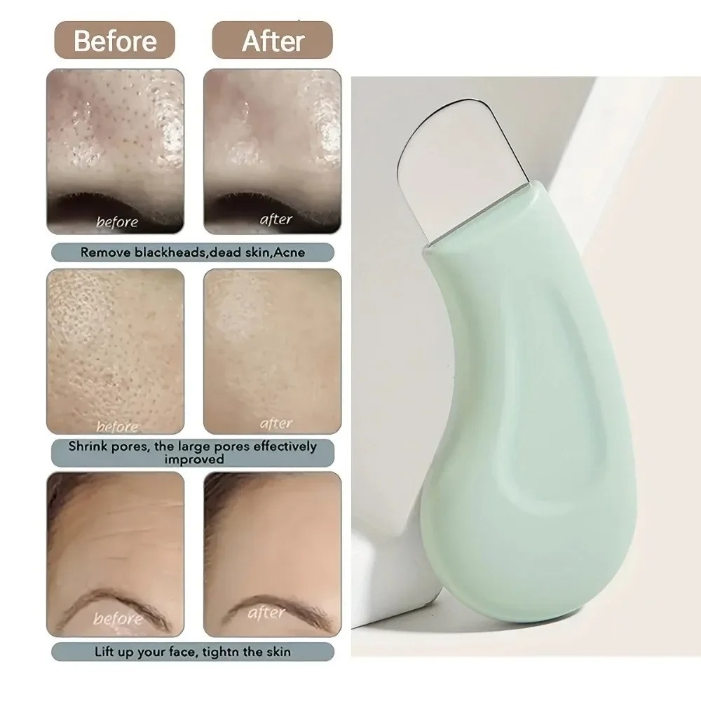 Deep Cleansing Blackhead White - Nasal Aspirator review and price