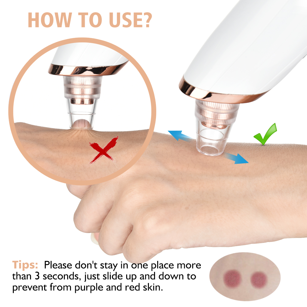 Blackhead Remover Vacuum Pore  - Nasal Aspirator review and price