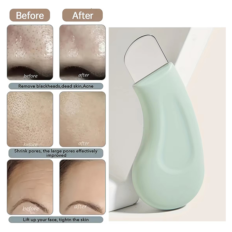 Deep Cleansing Facial Blackhea - Nasal Aspirator review and price